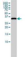 Anti-RLBP1 Mouse Monoclonal Antibody [clone: 4H5]