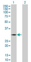 Anti-ABCC10 Rabbit Polyclonal Antibody