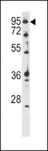 Anti-ATXN1 Rabbit Polyclonal Antibody (HRP (Horseradish Peroxidase))