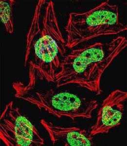 Anti-KLF6 Rabbit Polyclonal Antibody