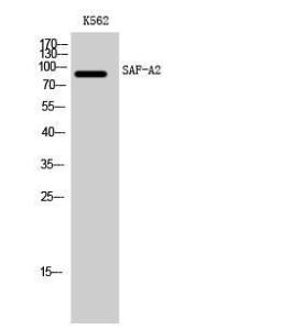 Western blot analysis of K562 cells using Anti-HNRNPUL2 Antibody