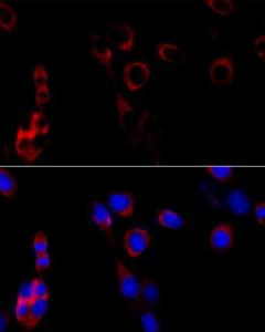 Immunofluorescence analysis of NIH/3T3 cells using Anti-GRP94 Antibody (A305806) at a dilution of 1:100 (40x lens) DAPI was used to stain the cell nuclei (blue)