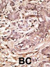 Anti-SUMO4 (M55 Wild type) Rabbit Polyclonal Antibody