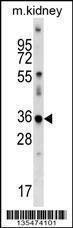 Anti-CDKL4 Rabbit Polyclonal Antibody (AP (Alkaline Phosphatase))