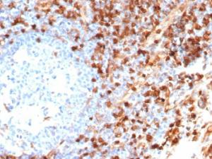 Immunohistochemical analysis of formalin-fixed, paraffin-embedded human tonsil tissue using Anti-Annexin A1 Antibody [ANXA1/6452R]