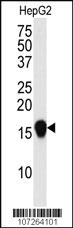 Anti-SUMO4 (V55 Mutant) Rabbit Polyclonal Antibody