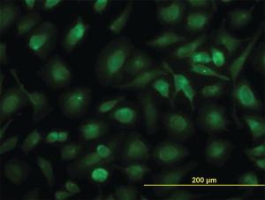 Anti-RLBP1 Mouse Monoclonal Antibody [clone: 4H5]