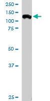 Anti-HLTF Goat Polyclonal Antibody