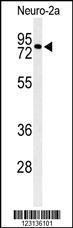 Anti-CIRH1A Rabbit Polyclonal Antibody (APC (Allophycocyanin))