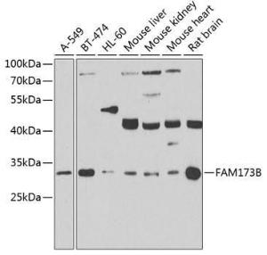 Western blot analysis of extracts of various cell lines, using Anti-ATPSCKMT Antibody (A10140) at 1:1,000 dilution