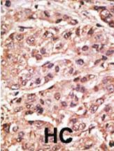 Anti-SUMO4 (V55 Mutant) Rabbit Polyclonal Antibody