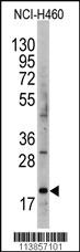 Anti-AGR2 Rabbit Polyclonal Antibody