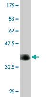 Anti-CACNA1F Mouse Monoclonal Antibody [clone: 1H6]