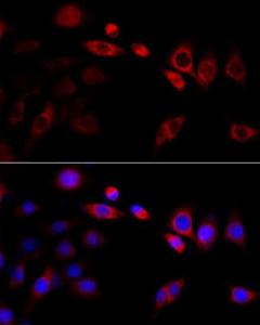 Immunofluorescence analysis of PC-12 cells using Anti-GRP94 Antibody (A305806) at a dilution of 1:100 (40x lens) DAPI was used to stain the cell nuclei (blue)