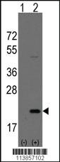 Anti-AGR2 Rabbit Polyclonal Antibody