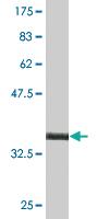 Anti-MSC Mouse Monoclonal Antibody [clone: 1D1]