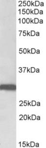 EB11981 (0.1 µg/ml) staining of Human Lung lysate (35 µg protein in RIPA buffer). Primary incubation was 1 hour. Detected by chemiluminescence.