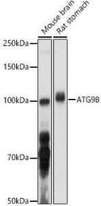 Antibody anti-ATG9B 100 µl