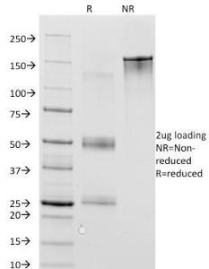 Anti-MAGE 1 antibody