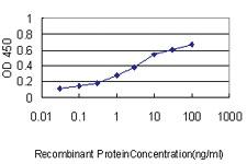 Anti-RLBP1 Mouse Monoclonal Antibody [clone: 4H5]