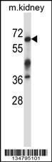 Anti-IRAK3 Rabbit Polyclonal Antibody (FITC (Fluorescein Isothiocyanate))