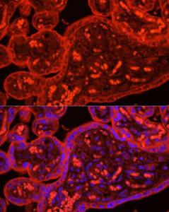 Antibody anti-ATG9B 100 µl