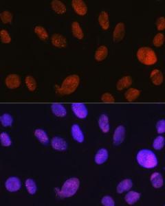 Immunofluorescence analysis of C6 cells using Anti-SNF2H Antibody [ARC0795] (A308440) at a dilution of 1:100 (40x lens). DAPI was used to stain the cell nuclei (blue)