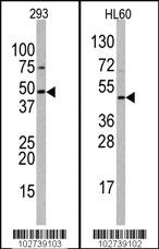 Anti-SUV39H2 Rabbit Polyclonal Antibody