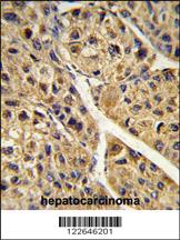 Anti-OSM Rabbit Polyclonal Antibody