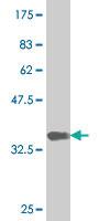 Anti-NEUROD6 Mouse Monoclonal Antibody [clone: 3B3]