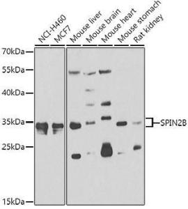 Anti-SPIN2B antibody