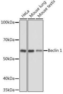 Western blot analysis of extracts of various cell lines, using Anti-Beclin 1 Antibody (A80890) at 1:1,000 dilution. The secondary antibody was Goat Anti-Rabbit IgG H&L Antibody (HRP) at 1:10,000 dilution.