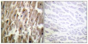 Antibody anti-CRYAB phospho SER45 100 µg