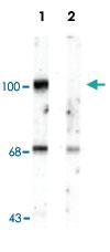 Anti-GRIA2 Rabbit Polyclonal Antibody