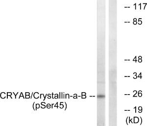 Antibody anti-CRYAB phospho SER45 100 µg