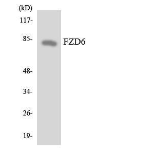 Western blot analysis of the lysates from 293 cells using Anti-FZD6 Antibody