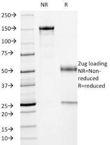 SDS-PAGE analysis of Anti-p53 Antibody [PCRP-TP53-1F7] under non-reduced and reduced conditions; showing intact IgG and intact heavy and light chains, respectively. SDS-PAGE analysis confirms the integrity and purity of the antibody