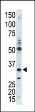 Anti-CDK1 Rabbit Polyclonal Antibody