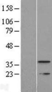 Anti-PMAIP1 Mouse Monoclonal Antibody [clone: 114C307.1]