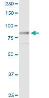 Anti-MST1 Polyclonal Antibody Pair