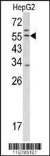 Anti-TMPRSS2 Rabbit Polyclonal Antibody