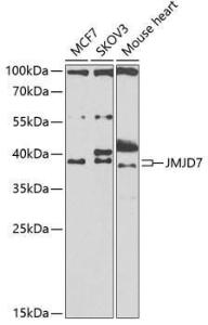 Western blot analysis of extracts of various cell lines, using Anti-JMJD7 Antibody (A10145) at 1:1,000 dilution