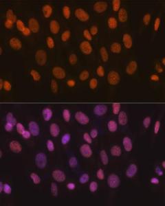 Immunofluorescence analysis of NIH-3T3 cells using Anti-SNF2H Antibody [ARC0795] (A308440) at a dilution of 1:100 (40x lens). DAPI was used to stain the cell nuclei (blue)