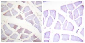 Immunohistochemical analysis of paraffin-embedded human skeletal muscle using Anti-CRYAB (phospho Ser19) Antibody The right hand panel represents a negative control, where the antibody was pre-incubated with the immunising peptide