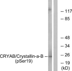 Western blot analysis of lysates from HepG2 cells treated with nocodazole 1 µg/ml 16h using Anti-CRYAB (phospho Ser19) Antibody The right hand lane represents a negative control, where the antibody is blocked by the immunising peptide