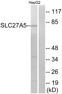 Western blot analysis of lysates from HepG2 cells using Anti-SLC27A5 Antibody The right hand lane represents a negative control, where the antibody is blocked by the immunising peptide