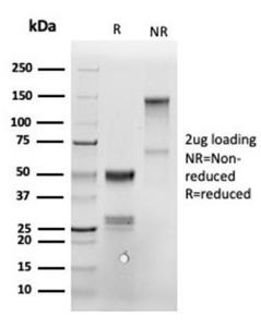 SDS-PAGE analysis of Anti-Annexin A1 Antibody [ANXA1/6452R] under non-reduced and reduced conditions; showing intact IgG and intact heavy and light chains, respectively. SDS-PAGE analysis confirms the integrity and purity of the antibody.