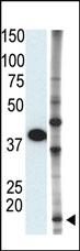 Anti-SUMO2 Rabbit Polyclonal Antibody