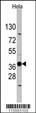 Anti-EDA Rabbit Polyclonal Antibody