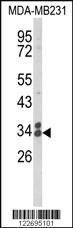 Anti-CLTA Rabbit Polyclonal Antibody